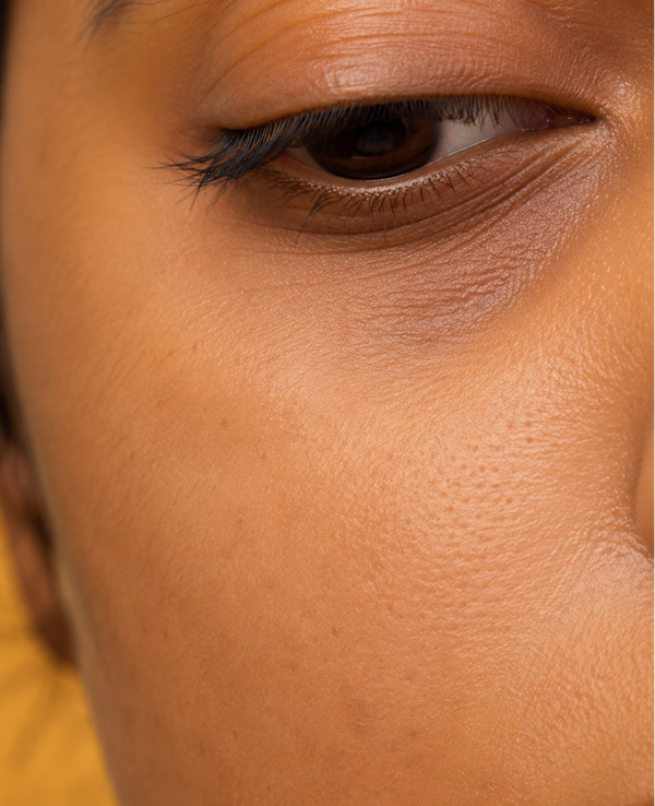 Skin Barrier