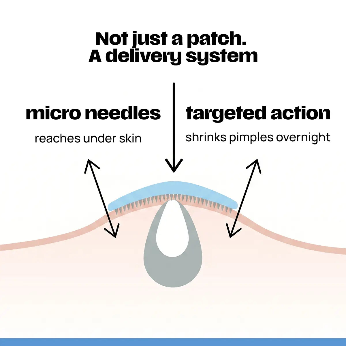 ZAP Microneedle acne patches