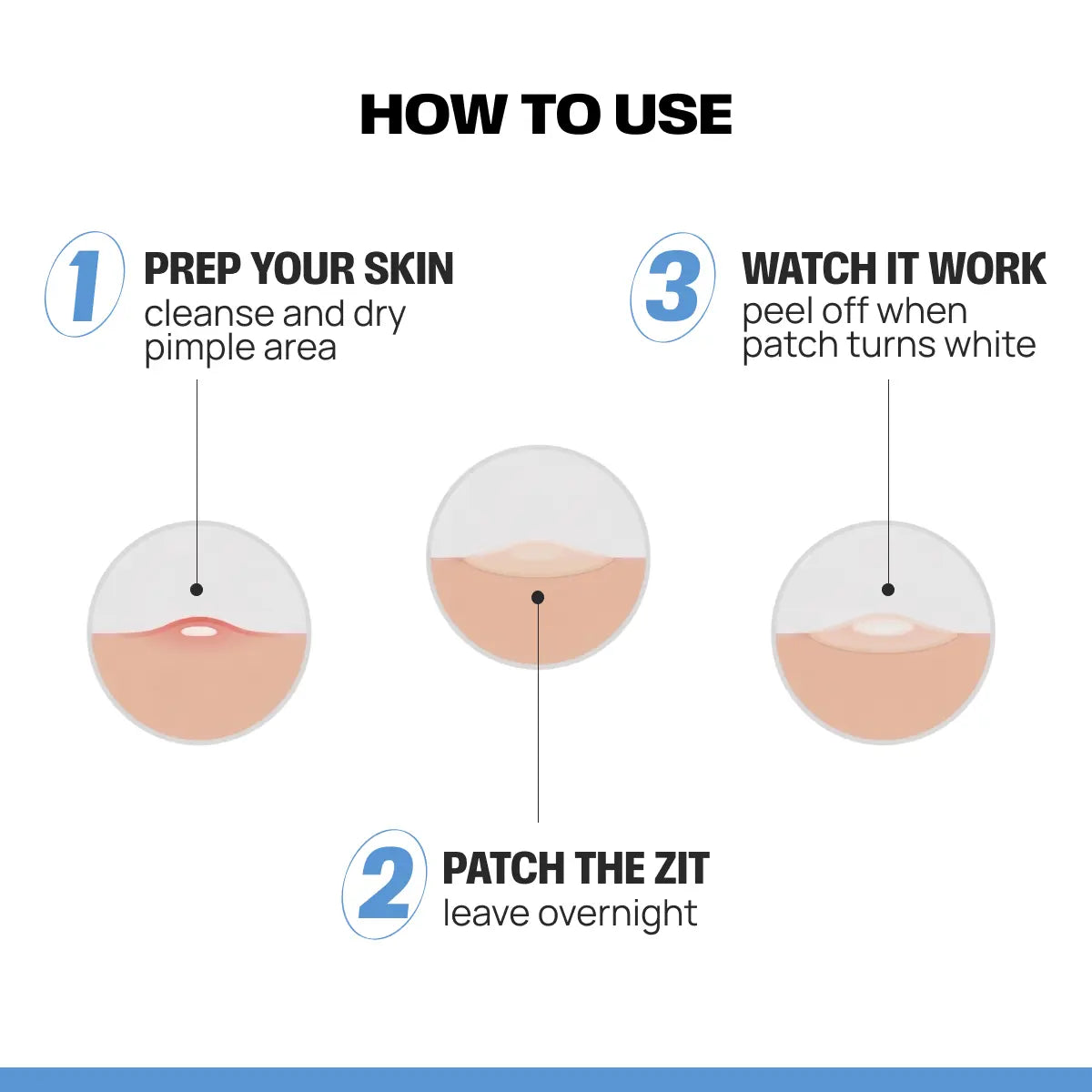 ZAP Microneedle acne patches
