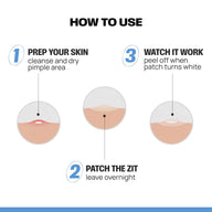 ZAP Microneedle acne patches