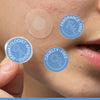 ZAP Microneedle acne patches