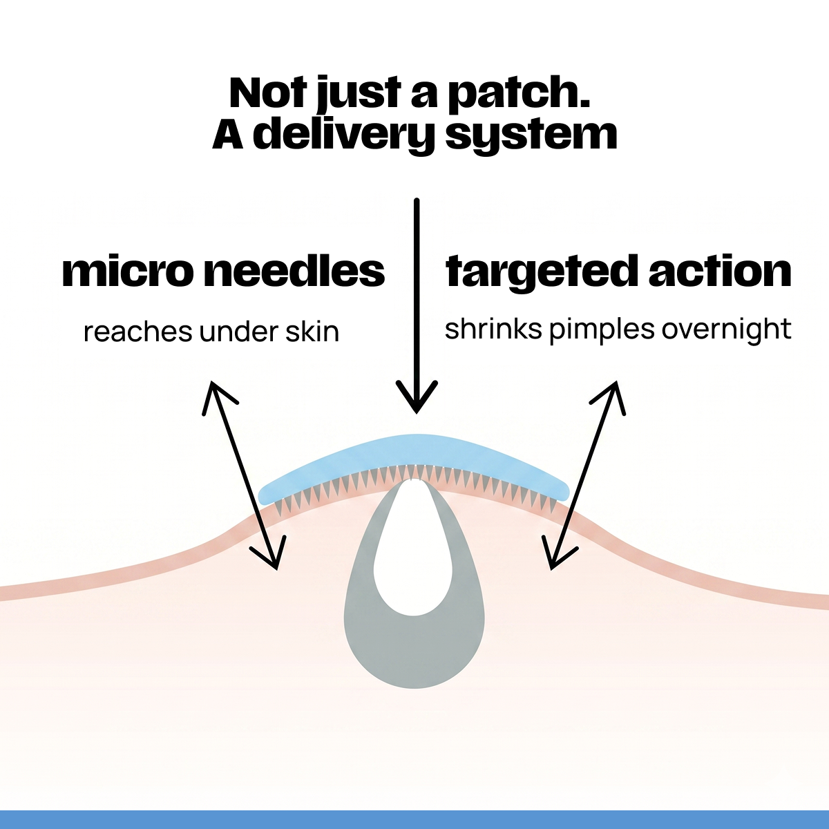 NO ZIT KIT: Clear Skin Trio